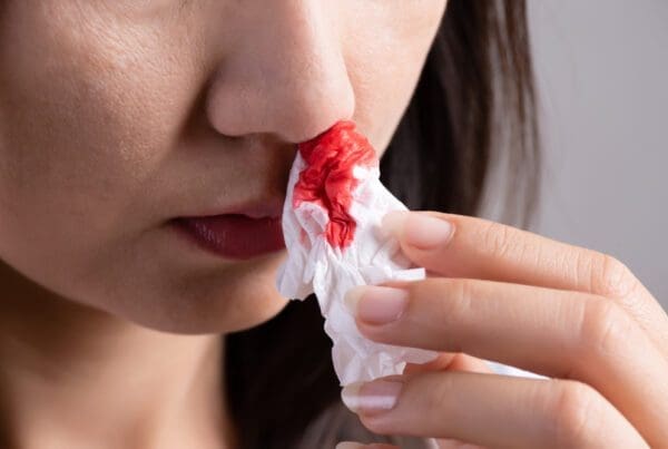 Dealing with a Nosebleed 1 shutterstock 1484520119